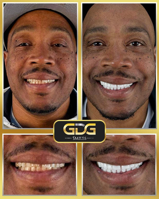 Images GDG Smiles