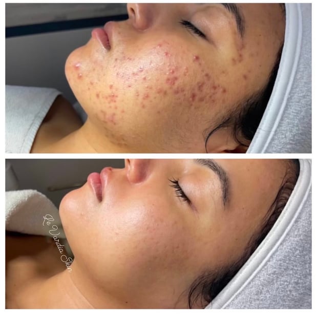 Images Le Vardia Skin