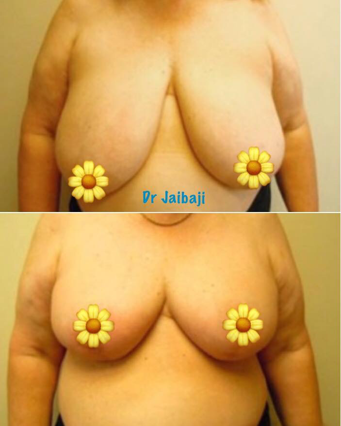 Jaibaji Plastic Surgery Photo