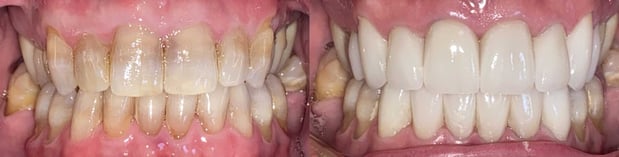 Images Castle Rock Family Dental