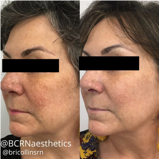 Images BCRN Aesthetics MedSpa