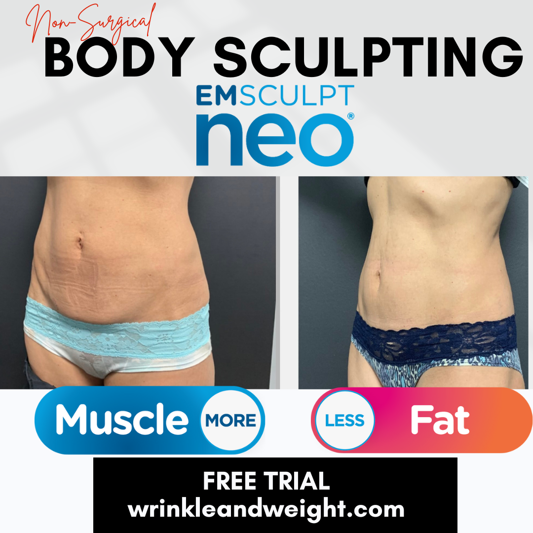 Body Sculpting and Contouring, Westerville, OH