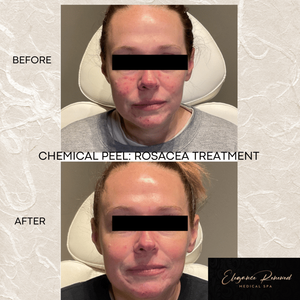 Images Elegance Renewed Medical Spa