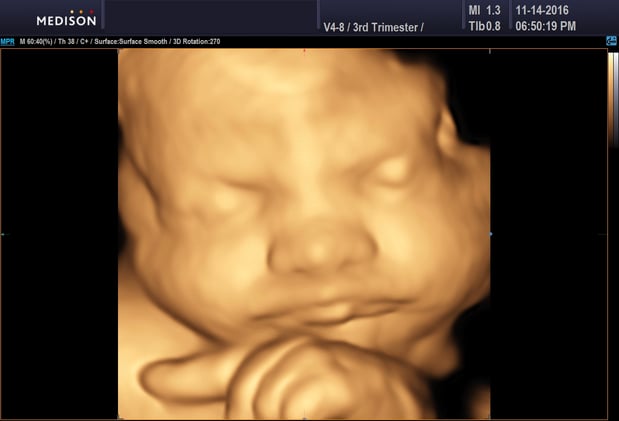 Images Heavenly 3D 4D Ultrasounds