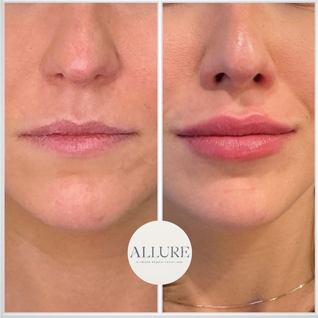 Images Clinique Médico-Esthétique Allure