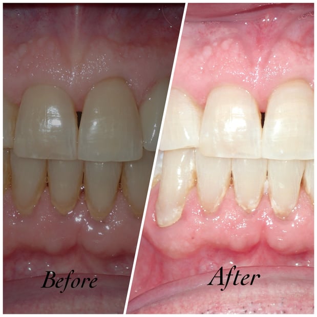 Images Reston Heights Dental