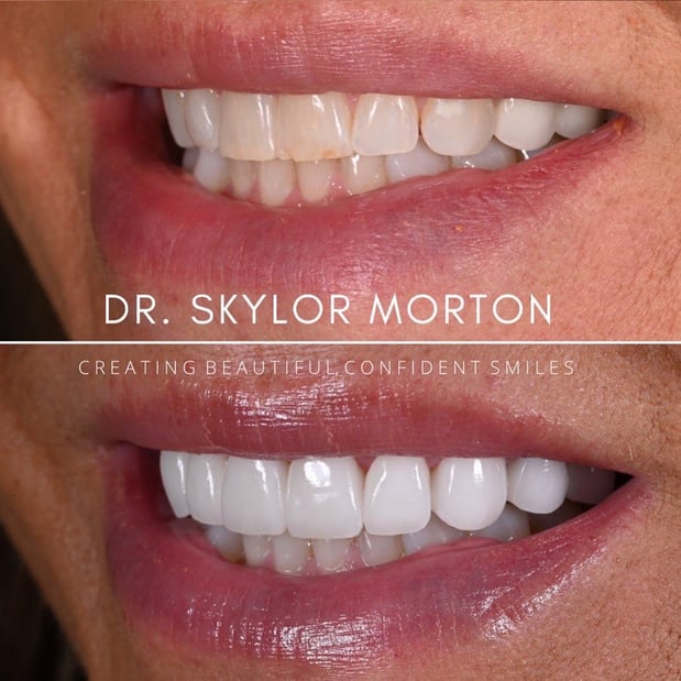 Images Nashville Wisdom Teeth and Implant Solutions