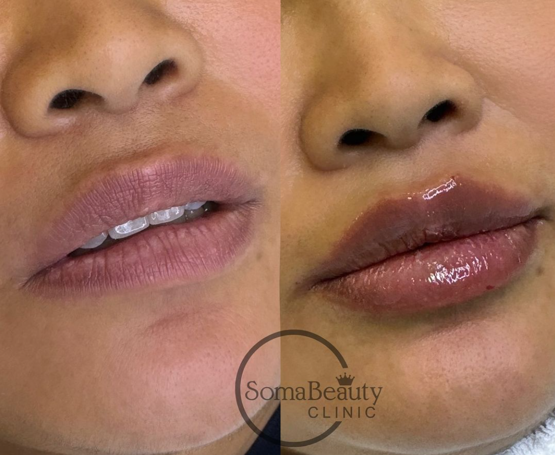Images Soma Beauty Clinic