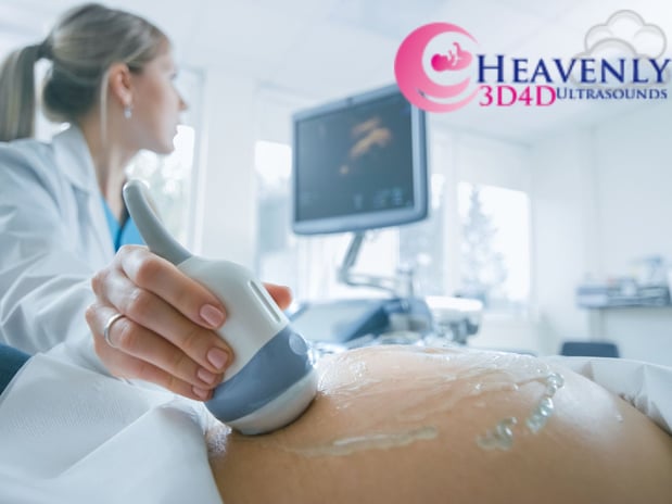 Images Heavenly 3D 4D Ultrasounds