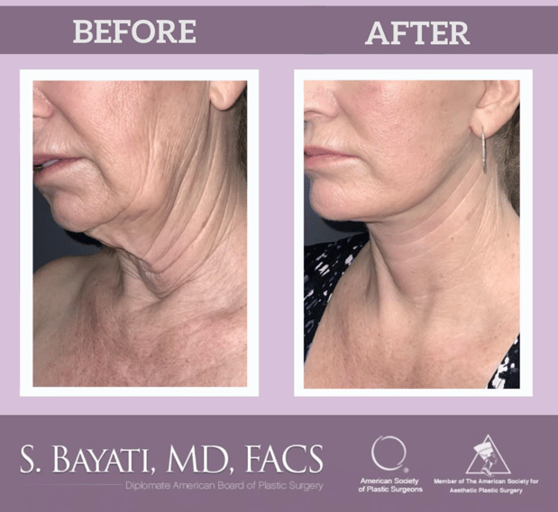 Images Semira Bayati, MD, FACS