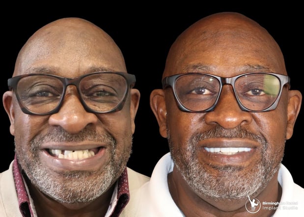 Images Birmingham Dental Implant Studio