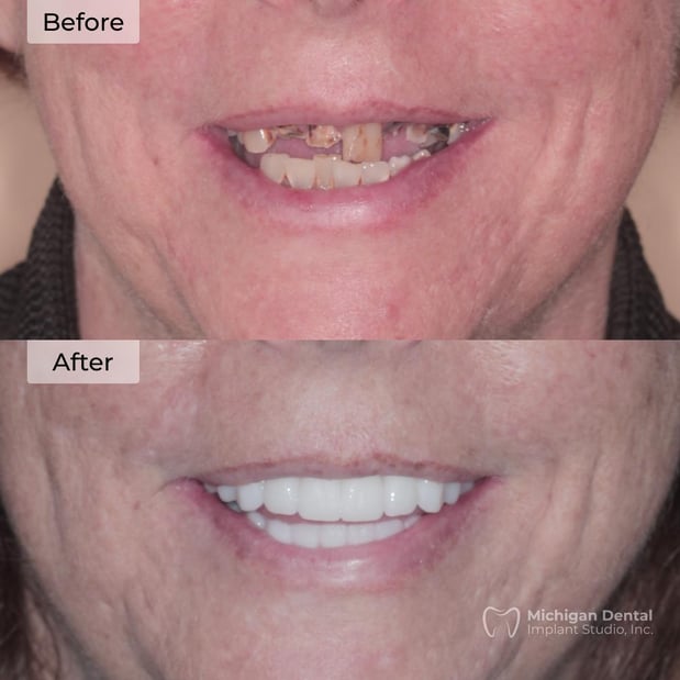 Images Michigan Dental Implant Studio