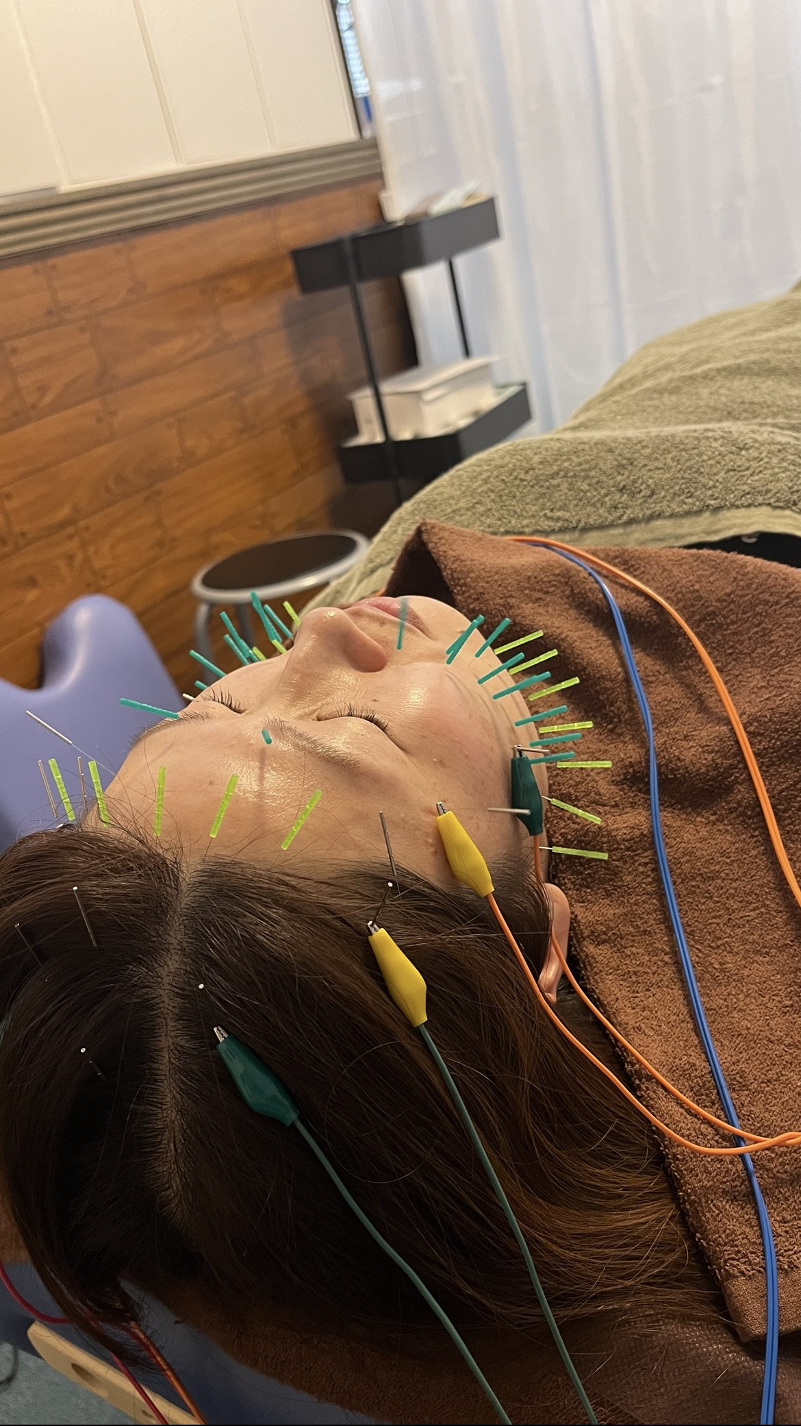 Images 鍼処MINAOSHI