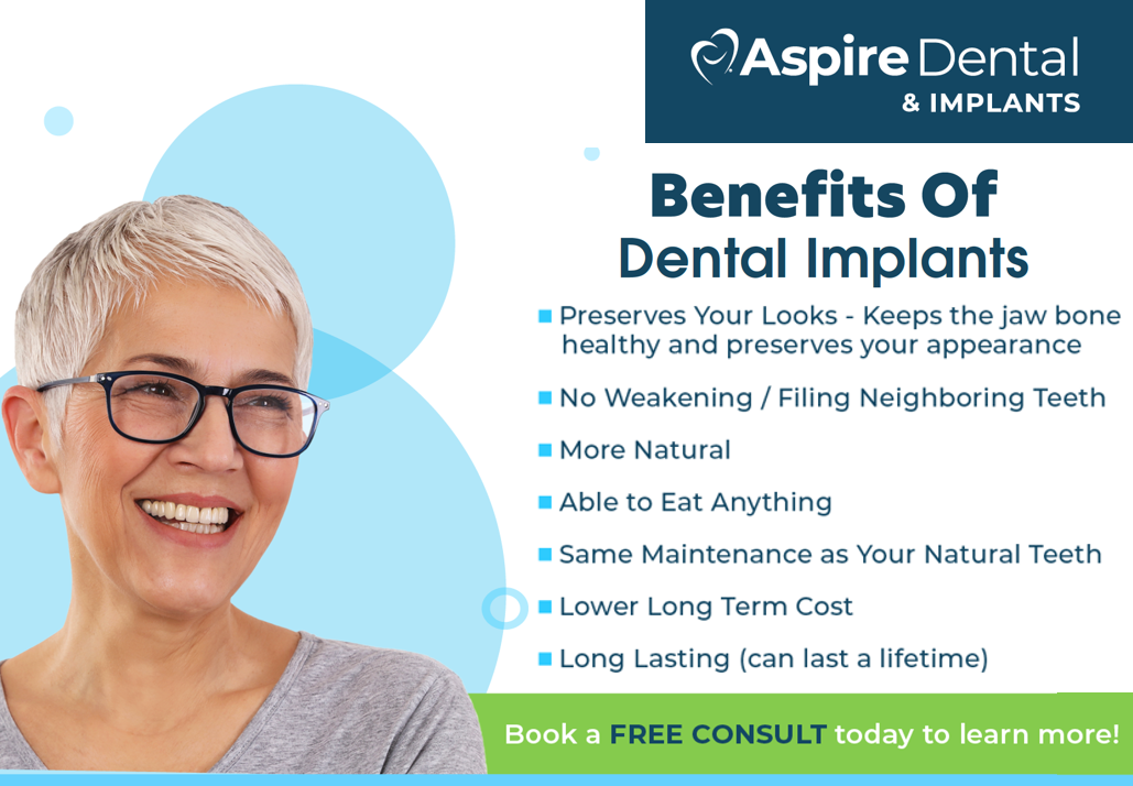 Learn about the benefits of dental implants!