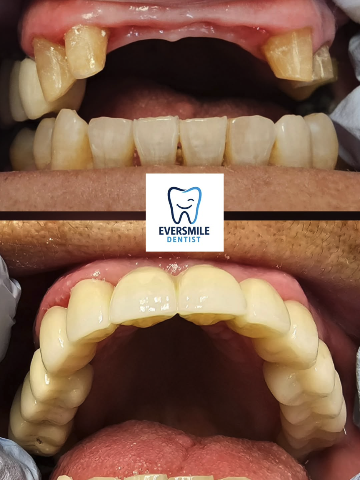 Eversmile Dentist Image