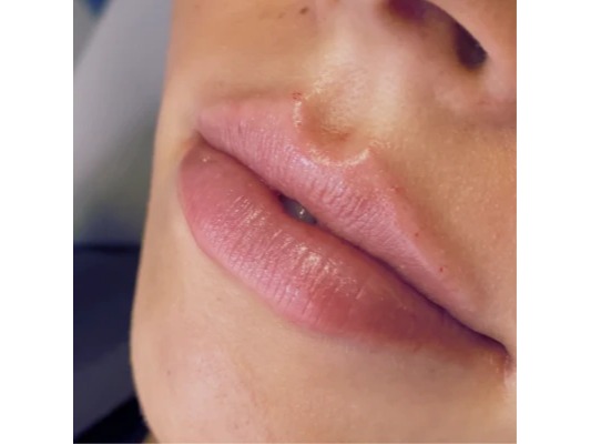 LIVION, Neuer Wall 38 in Hamburg