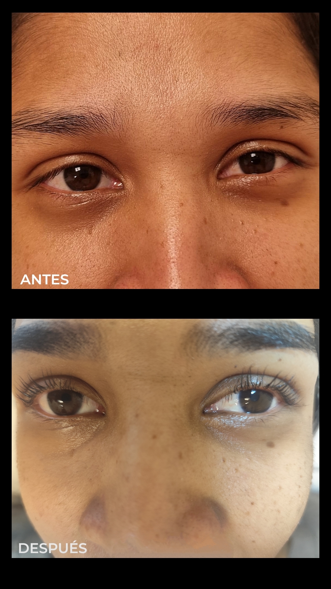 Images Fv Láser Nails Beauty