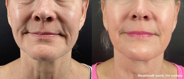 Images EliteBio: Hormone and Aesthetic Solutions