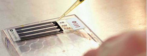 Quidel Germany GmbH, Leibnizstraße 11 in Kornwestheim