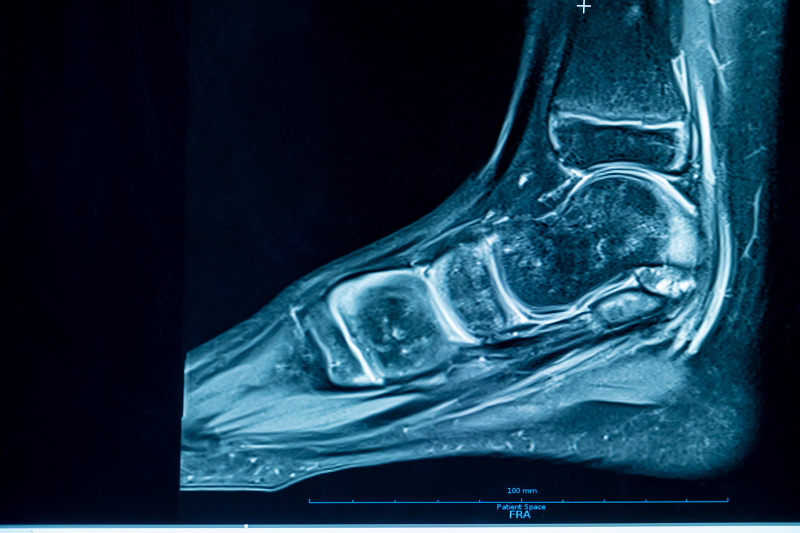 Kundenbild groß 11 Dr. Lins | Ihre MRT Radiologie Privatpraxis Nürnberg | Schnelle Termine | Vorsorge und mehr