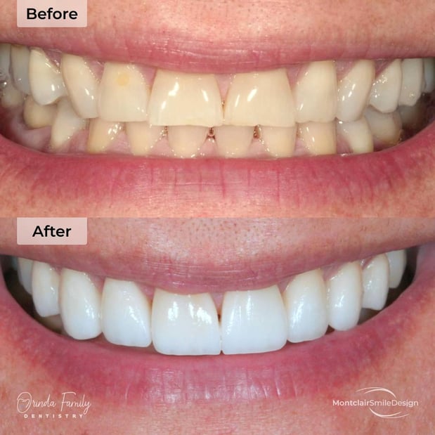 Images Orinda Family Dentistry