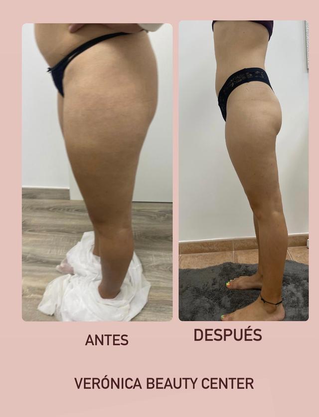Images Verónica Beauty Center