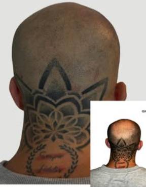 Images Giorgia Hair Clinic