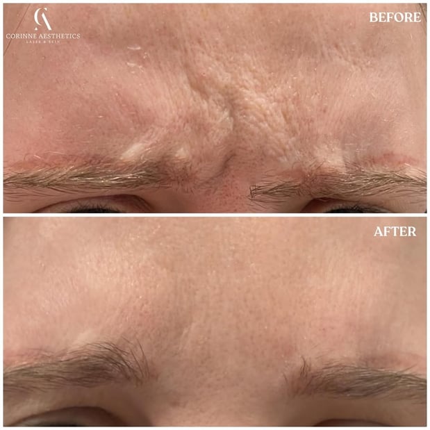Images Corinne Aesthetics | Laser & Skin