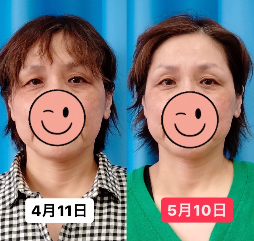 Images 目元・口元のたるみ&眉間シワ改善専門サロン