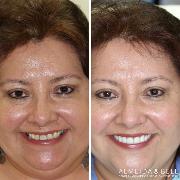 Images Almeida & Bell Dental Lone Tree - General, Cosmetic, and Implant Dentistry