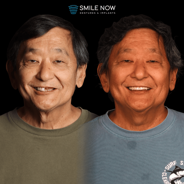 Images Smile Now Milwaukee Dentures and Implants
