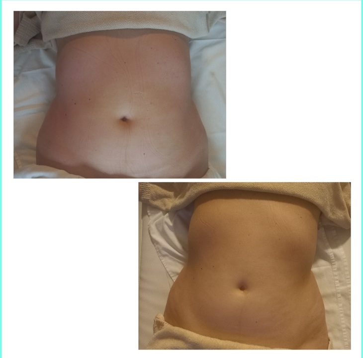 Images VitalmassageSevilla