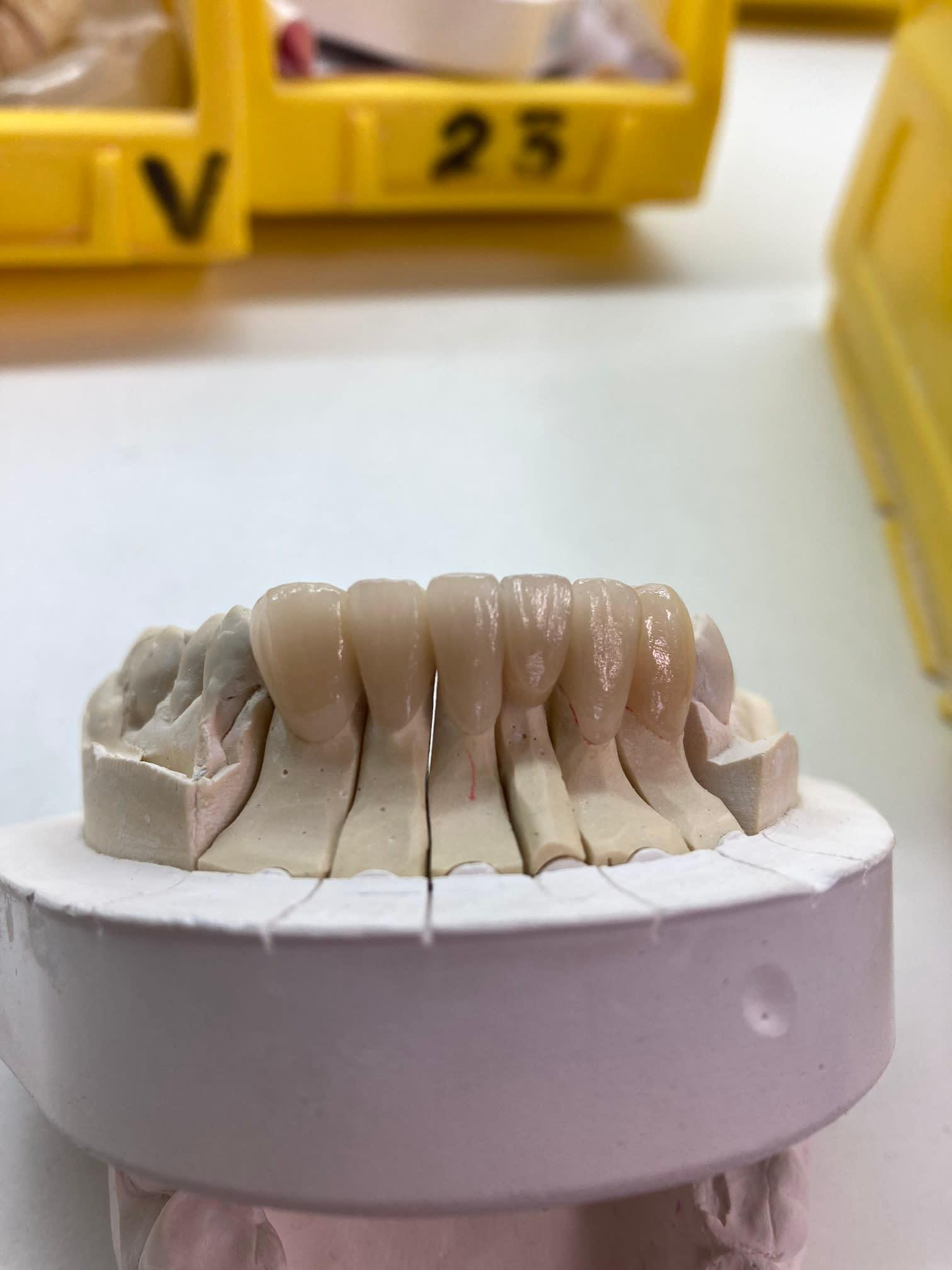 Images Steve Butler Dental Ceramics Ltd