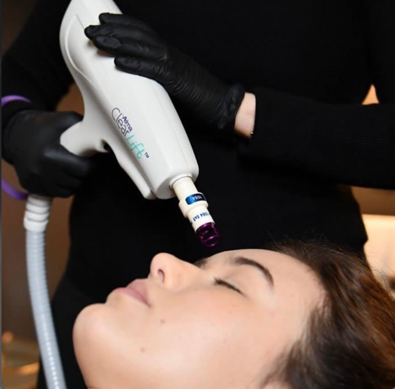 Alma laser treatment in Colorado Springs by Marysol Gill, designed for advanced skin rejuvenation, pigmentation improvement, sun spot treatment, uneven skin tone, and a smoother, brighter-looking complexion. A professional laser skin service for clients seeking customized skin renewal, facial rejuvenation, and visible skin improvement without surgery.