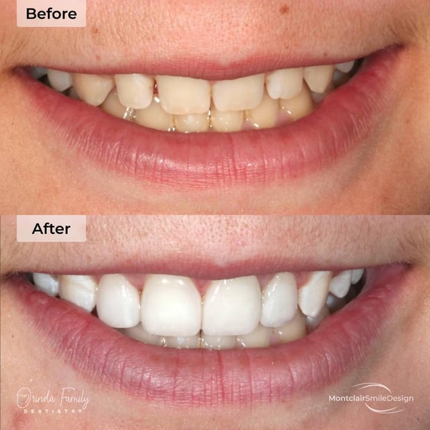 Images Orinda Family Dentistry