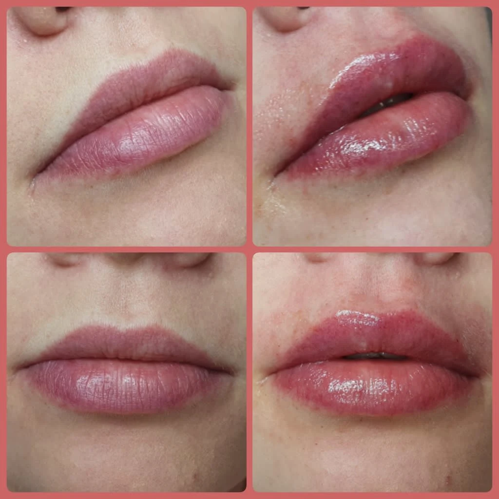 Images Lincoln Aesthetic