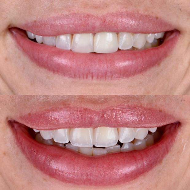 Images Modern Smiles