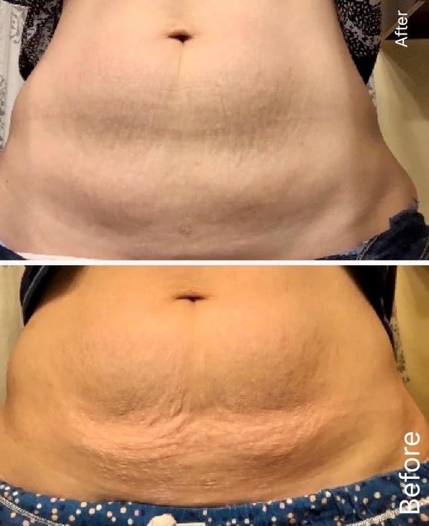 Images Sunkissed Med Spa