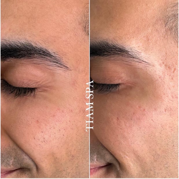 Images Tiam Medspa