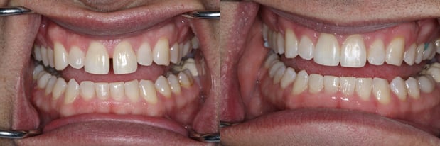 Images Cedar Hills Family Dentistry