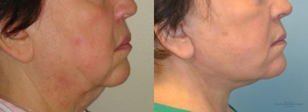 Images Providence Facial Plastic and Cosmetic Surgery