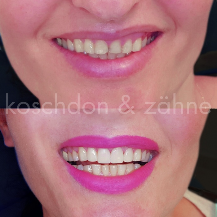 Dr. med. dent. M.Sc. Jakob Koschdon, Robert-Koch-Str. 5 in Neu-Isenburg