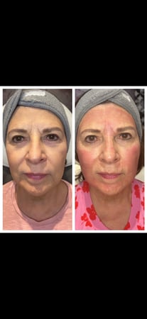 Images Body Lounge Park Cities - Whole Body Wellness & Medical Aesthetics, Dallas, TX