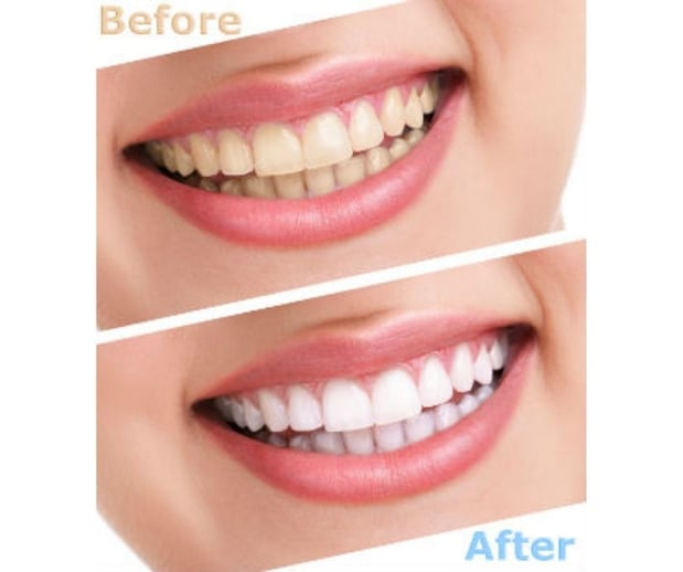 Images Silver State Dental