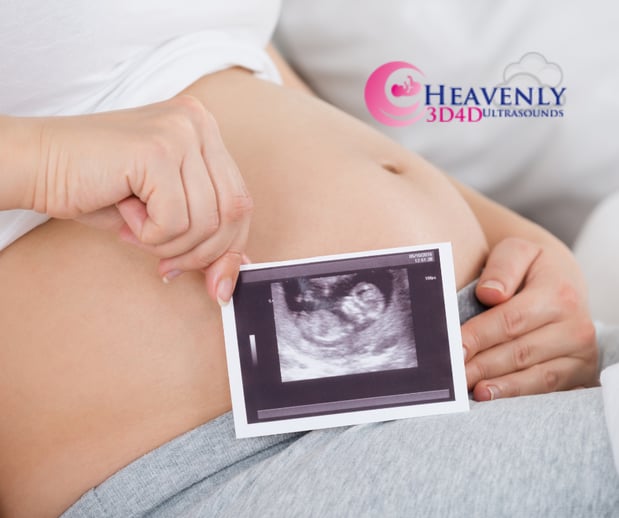 Images Heavenly 3D 4D Ultrasounds