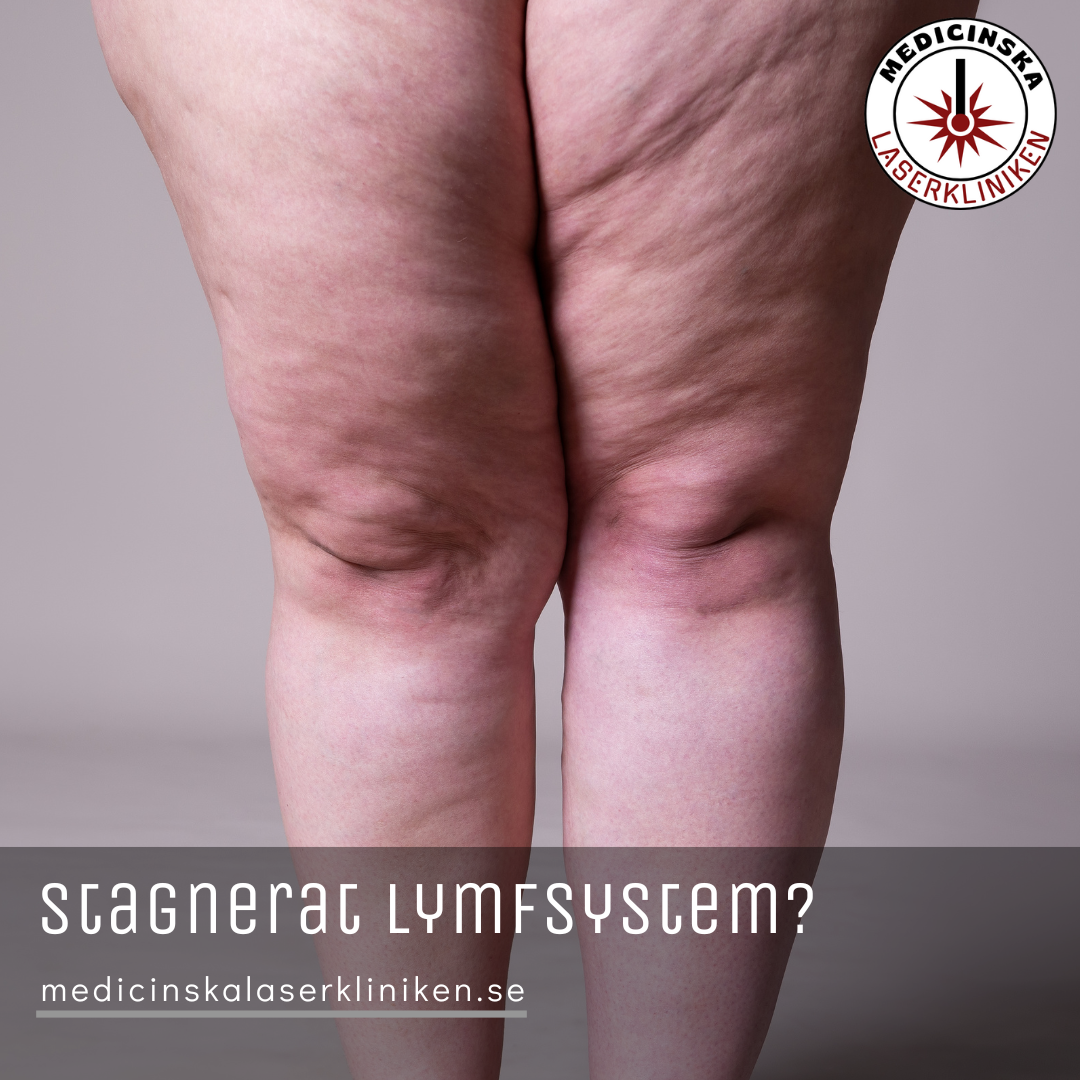 Images Medicinska Laserkliniken