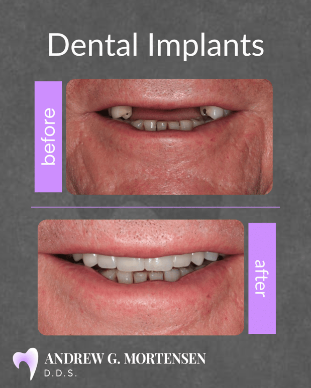 Images Andrew G. Mortensen, DDS