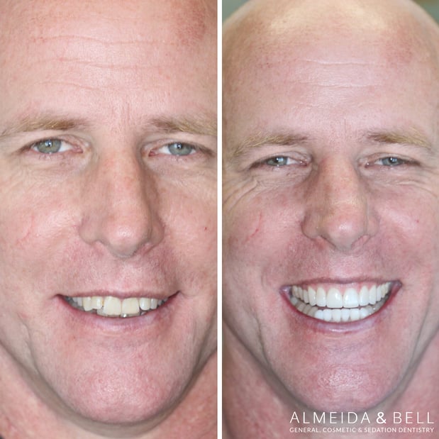 Images Almeida & Bell Dental Lone Tree - General, Cosmetic, and Implant Dentistry