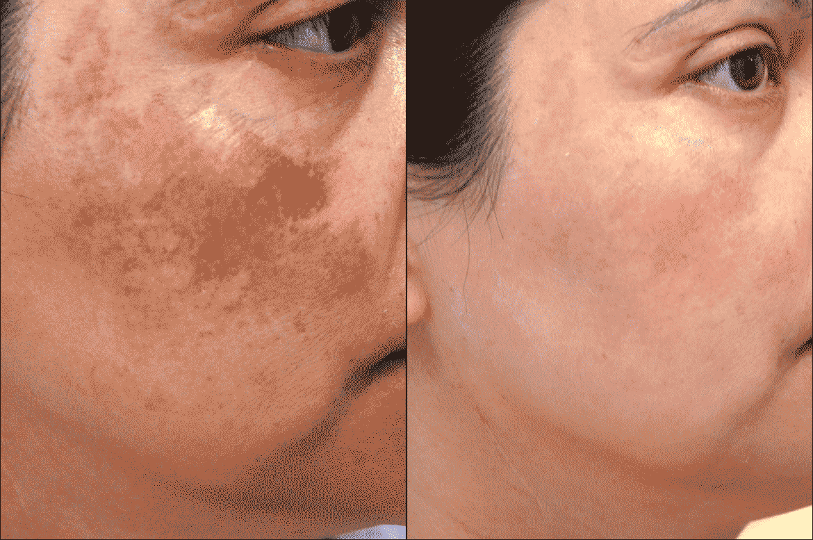 Images Medical Sthetic