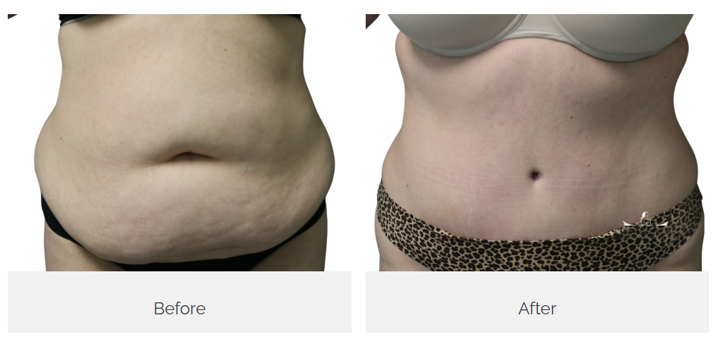 Castellano Cosmetic Surgery Center Image